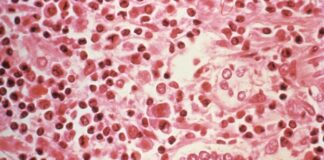 Les contamos sobre el Hantavirus